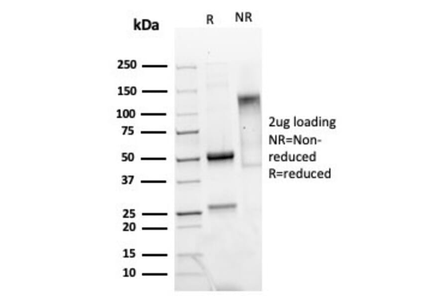 SDS-PAGE - Anti-Mammaglobin A Antibody [MGB/4811R] - BSA and Azide free (A252504) - Antibodies.com