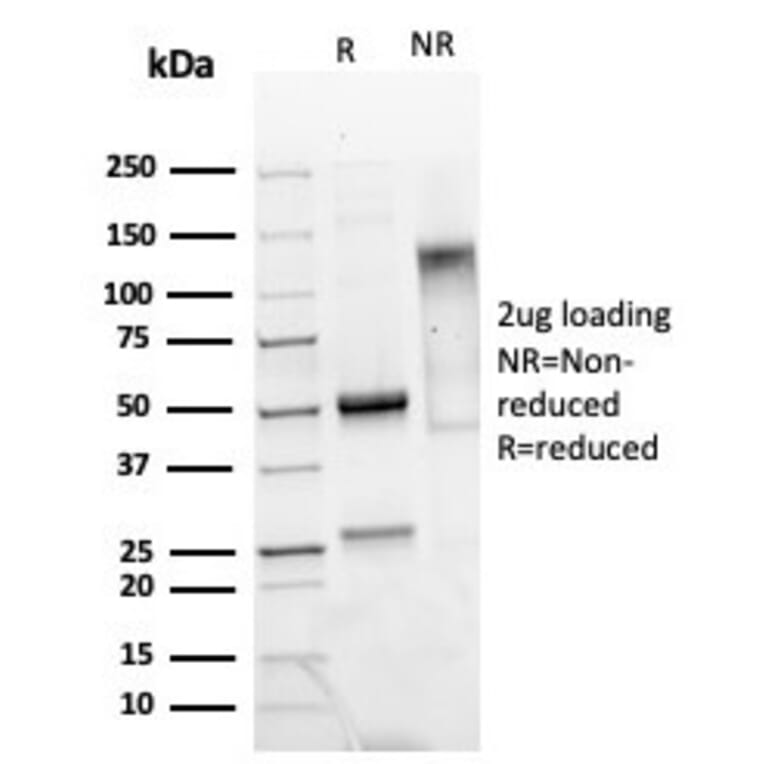 SDS-PAGE - Anti-Mammaglobin A Antibody [MGB/4811R] - BSA and Azide free (A252504) - Antibodies.com