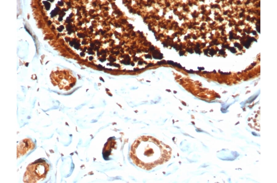 Immunohistochemistry - Anti-Mammaglobin A Antibody [MGB/4812R] - BSA and Azide free (A252505) - Antibodies.com