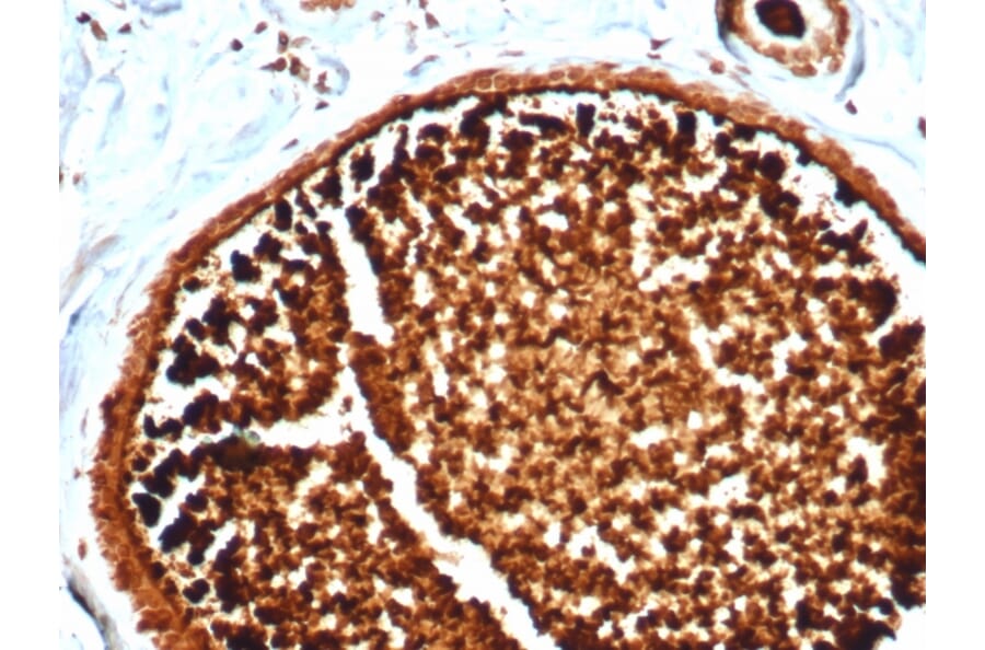Immunohistochemistry - Anti-Mammaglobin A Antibody [MGB/4812R] - BSA and Azide free (A252504) - Antibodies.com