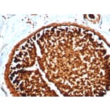 Immunohistochemistry - Anti-Mammaglobin A Antibody [MGB/4812R] - BSA and Azide free (A252504) - Antibodies.com