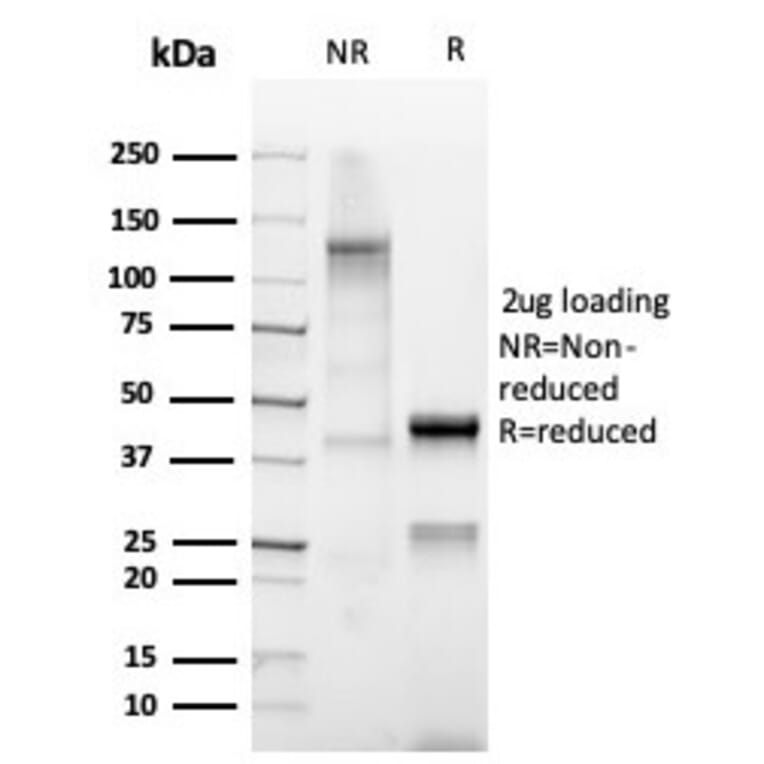 SDS-PAGE - Anti-Mammaglobin A Antibody [MGB/4812R] - BSA and Azide free (A252505) - Antibodies.com
