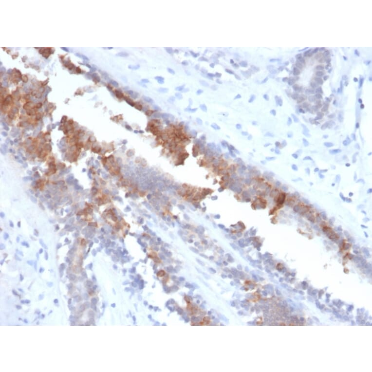 Immunohistochemistry - Anti-Mammaglobin A Antibody [MGB/2123R] - BSA and Azide free (A252505) - Antibodies.com