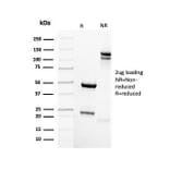 SDS-PAGE - Anti-Mammaglobin A Antibody [MGB/2123R] - BSA and Azide free (A252506) - Antibodies.com