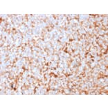 Immunohistochemistry - Anti-Mammaglobin A Antibody [MGB/2682R] - BSA and Azide free (A252507) - Antibodies.com