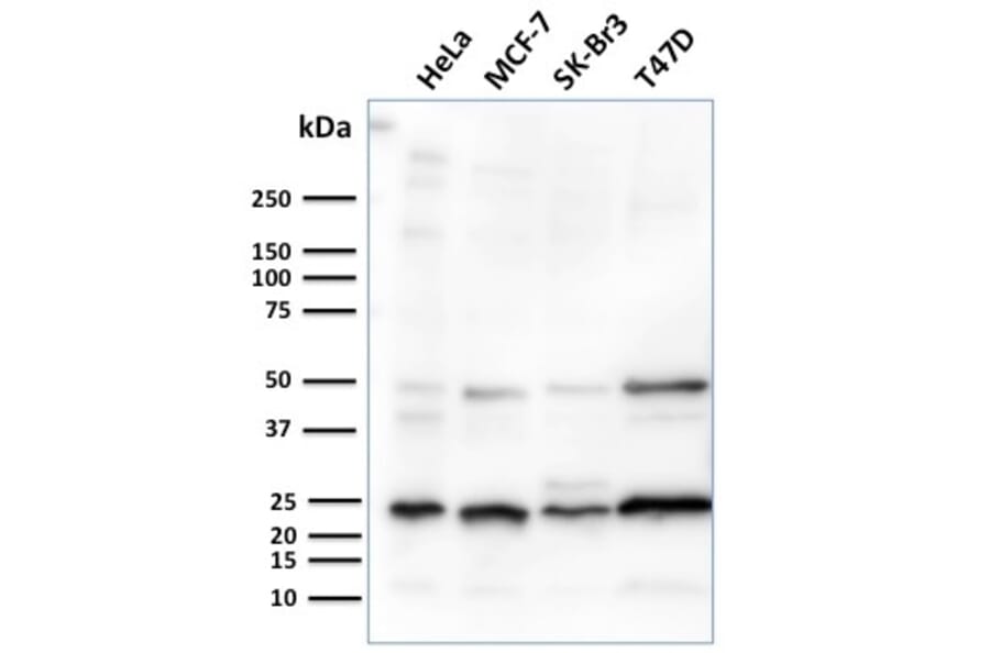 Western Blot - Anti-Mammaglobin A Antibody [MGB/2682R] - BSA and Azide free (A252507) - Antibodies.com