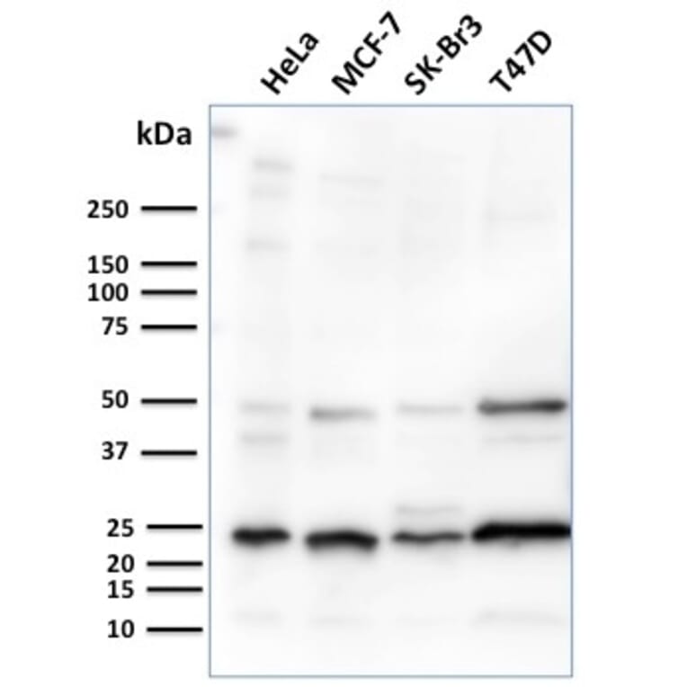 Western Blot - Anti-Mammaglobin A Antibody [MGB/2682R] - BSA and Azide free (A252507) - Antibodies.com