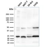 Western Blot - Anti-Mammaglobin A Antibody [MGB/2682R] - BSA and Azide free (A252507) - Antibodies.com