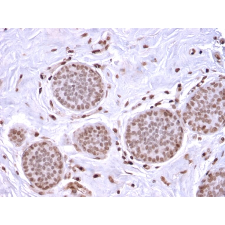 Immunohistochemistry - Anti-Mammaglobin A Antibody [MGB/2682R] - BSA and Azide free (A252507) - Antibodies.com