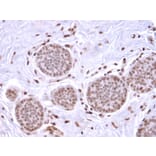 Immunohistochemistry - Anti-Mammaglobin A Antibody [MGB/2682R] - BSA and Azide free (A252507) - Antibodies.com