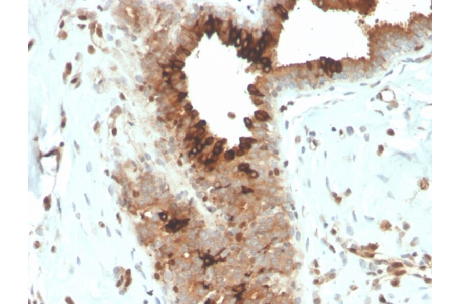 Immunohistochemistry - Anti-Mammaglobin A Antibody [MGB/4057R] - BSA and Azide free (A252508) - Antibodies.com