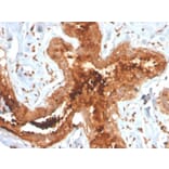 Immunohistochemistry - Anti-Mammaglobin A Antibody [MGB/4058R] - BSA and Azide free (A252509) - Antibodies.com