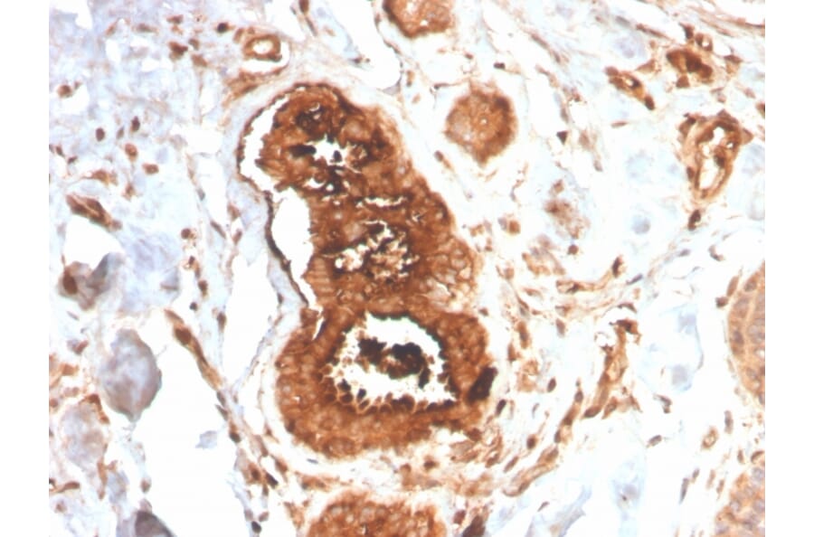 Immunohistochemistry - Anti-Mammaglobin A Antibody [MGB/4058R] - BSA and Azide free (A252508) - Antibodies.com