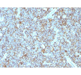 Immunohistochemistry - Anti-CD99 Antibody [MIC2/877] - BSA and Azide free (A252509) - Antibodies.com