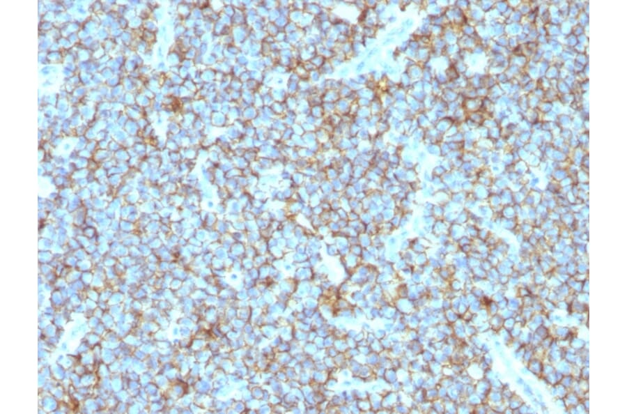 Immunohistochemistry - Anti-CD99 Antibody [MIC2/877] - BSA and Azide free (A252509) - Antibodies.com