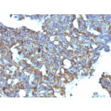 Immunohistochemistry - Anti-CD99 Antibody [MIC2/877] - BSA and Azide free (A252510) - Antibodies.com