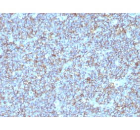 Immunohistochemistry - Anti-CD99 Antibody [SPM596] - BSA and Azide free (A252510) - Antibodies.com