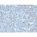 Immunohistochemistry - Anti-CD99 Antibody [SPM596] - BSA and Azide free (A252510) - Antibodies.com