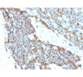 Immunohistochemistry - Anti-CD99 Antibody [12E7 + MIC2/877] - BSA and Azide free (A252511) - Antibodies.com