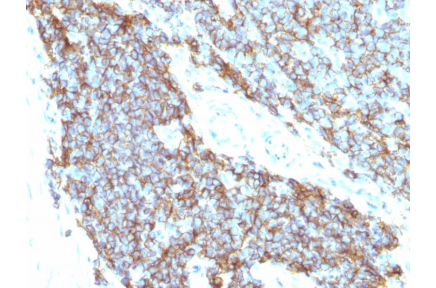 Immunohistochemistry - Anti-CD99 Antibody [12E7 + MIC2/877] - BSA and Azide free (A252511) - Antibodies.com