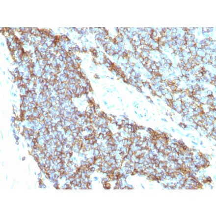 Immunohistochemistry - Anti-CD99 Antibody [12E7 + MIC2/877] - BSA and Azide free (A252511) - Antibodies.com