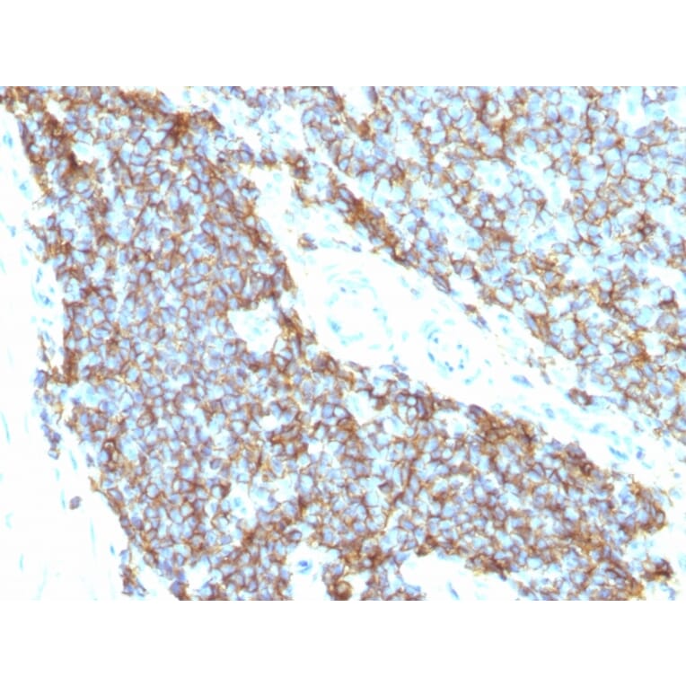 Immunohistochemistry - Anti-CD99 Antibody [12E7 + MIC2/877] - BSA and Azide free (A252511) - Antibodies.com