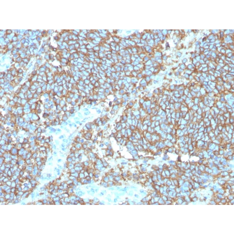 Immunohistochemistry - Anti-CD99 Antibody [rMIC2/3317] - BSA and Azide free (A252513) - Antibodies.com