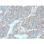 Immunohistochemistry - Anti-CD99 Antibody [rMIC2/3317] - BSA and Azide free (A252513) - Antibodies.com