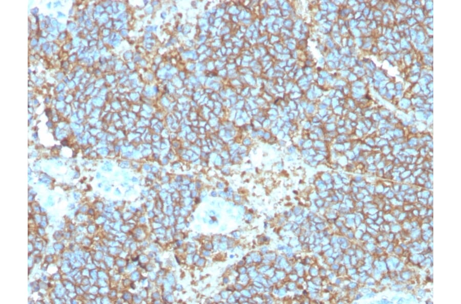 Immunohistochemistry - Anti-CD99 Antibody [rMIC2/3317] - BSA and Azide free (A252512) - Antibodies.com