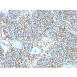 Immunohistochemistry - Anti-CD99 Antibody [rMIC2/3317] - BSA and Azide free (A252512) - Antibodies.com