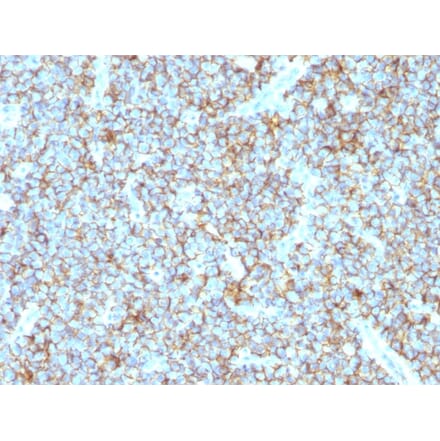 Immunohistochemistry - Anti-CD99 Antibody [MIC2/1495R] - BSA and Azide free (A252513) - Antibodies.com