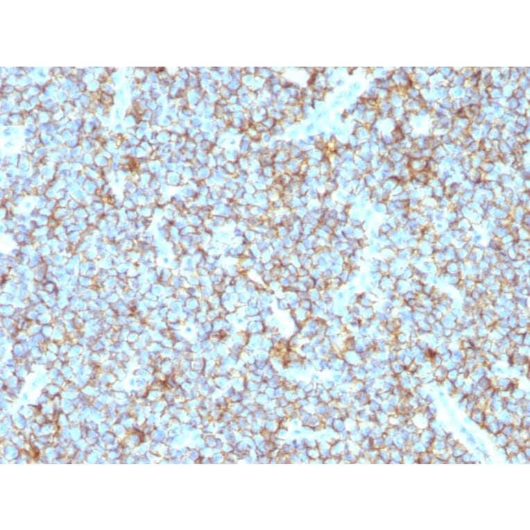 Immunohistochemistry - Anti-CD99 Antibody [MIC2/1495R] - BSA and Azide free (A252513) - Antibodies.com