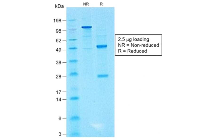 SDS-PAGE - Anti-CD99 Antibody [MIC2/1495R] - BSA and Azide free (A252514) - Antibodies.com