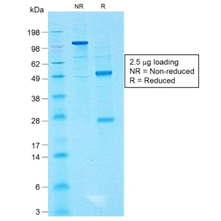 SDS-PAGE - Anti-CD99 Antibody [MIC2/1495R] - BSA and Azide free (A252514) - Antibodies.com