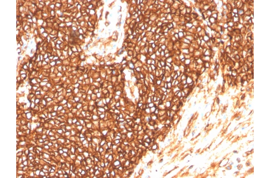 Immunohistochemistry - Anti-CD99 Antibody [MIC2/3478R] - BSA and Azide free (A252515) - Antibodies.com