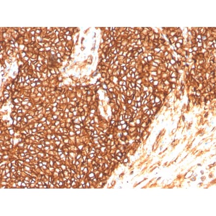 Immunohistochemistry - Anti-CD99 Antibody [MIC2/3478R] - BSA and Azide free (A252515) - Antibodies.com