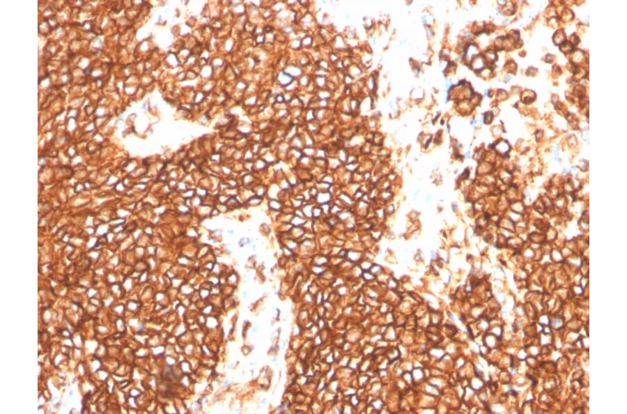 Immunohistochemistry - Anti-CD99 Antibody [MIC2/3478R] - BSA and Azide free (A252514) - Antibodies.com