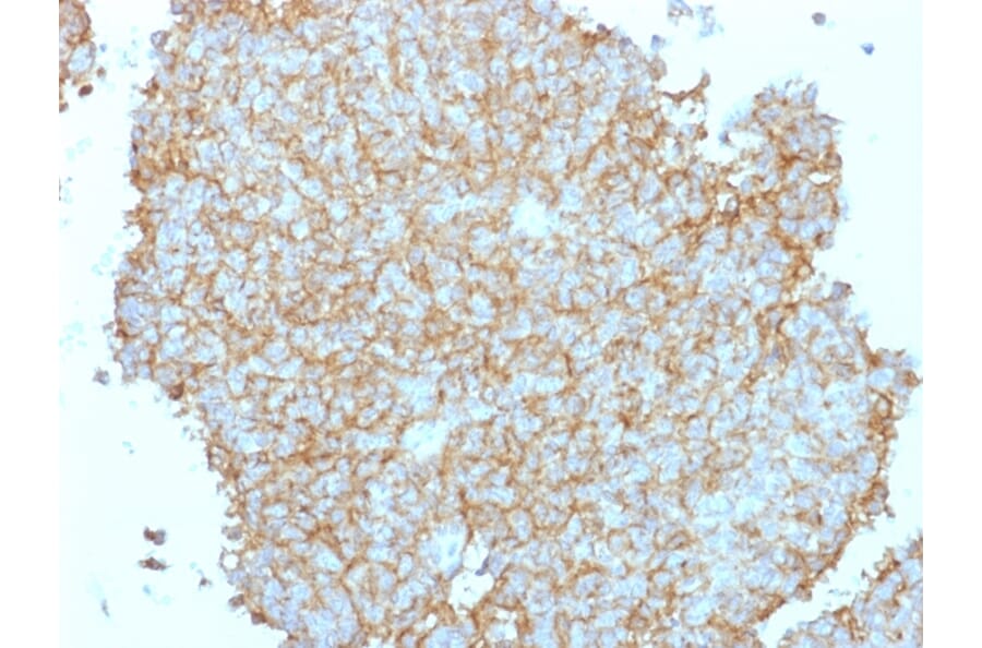 Immunohistochemistry - Anti-CD99 Antibody - BSA and Azide free (A252515) - Antibodies.com