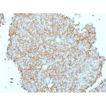 Immunohistochemistry - Anti-CD99 Antibody - BSA and Azide free (A252515) - Antibodies.com