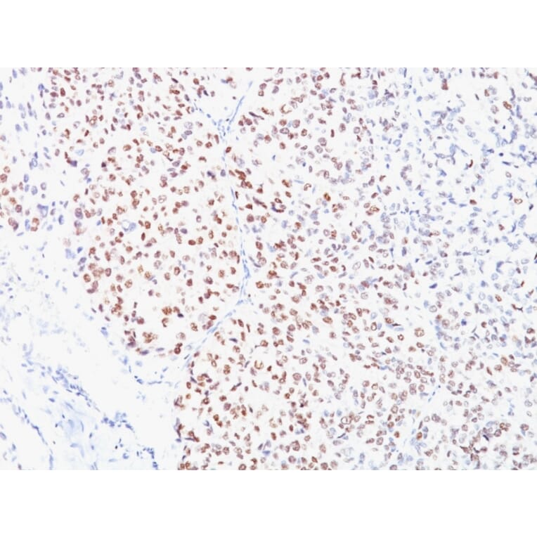 Immunohistochemistry - Anti-MiTF Antibody [D5] - BSA and Azide free (A252516) - Antibodies.com