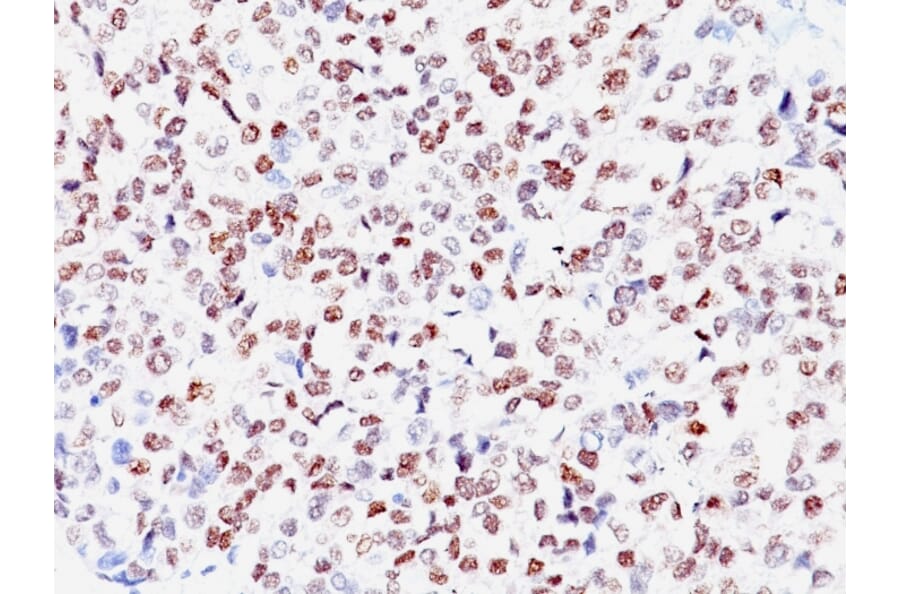 Immunohistochemistry - Anti-MiTF Antibody [SPM290] - BSA and Azide free (A252517) - Antibodies.com
