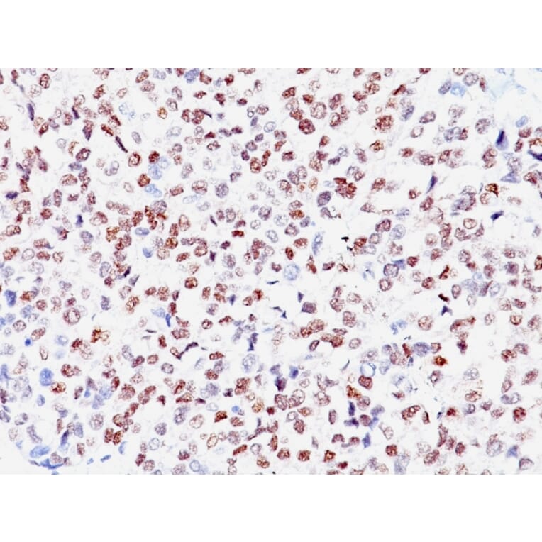 Immunohistochemistry - Anti-MiTF Antibody [SPM290] - BSA and Azide free (A252517) - Antibodies.com
