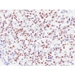 Immunohistochemistry - Anti-MiTF Antibody [SPM290] - BSA and Azide free (A252517) - Antibodies.com