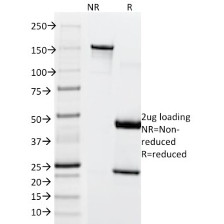 SDS-PAGE - Anti-MiTF Antibody [SPM290] - BSA and Azide free (A252518) - Antibodies.com