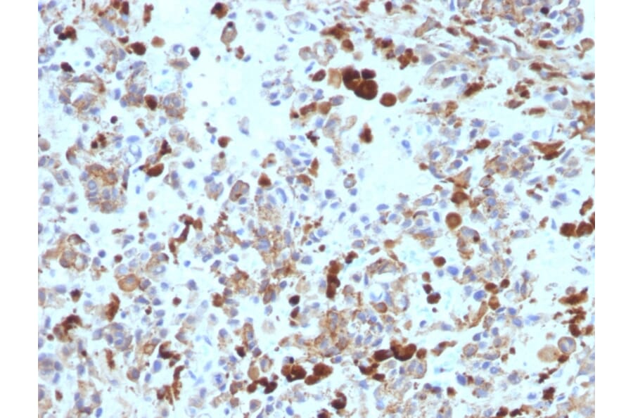 Immunohistochemistry - Anti-MiTF Antibody [MITF/915] - BSA and Azide free (A252518) - Antibodies.com
