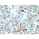 Immunohistochemistry - Anti-MiTF Antibody [MITF/915] - BSA and Azide free (A252518) - Antibodies.com
