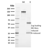 SDS-PAGE - Anti-MiTF Antibody [MITF/915] - BSA and Azide free (A252519) - Antibodies.com