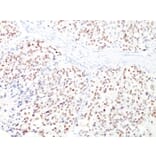 Immunohistochemistry - Anti-MiTF Antibody [D5 + MITF/915] - BSA and Azide free (A252519) - Antibodies.com