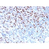 Immunohistochemistry - Anti-MiTF Antibody [MITF/2987R] - BSA and Azide free (A252521) - Antibodies.com