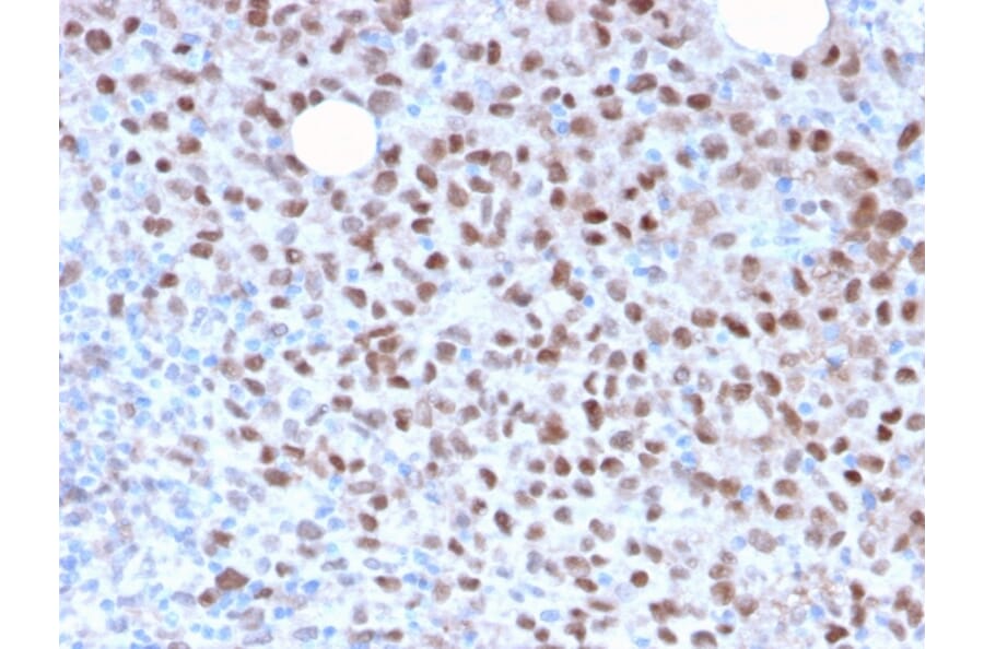Immunohistochemistry - Anti-MiTF Antibody [MITF/2987R] - BSA and Azide free (A252520) - Antibodies.com